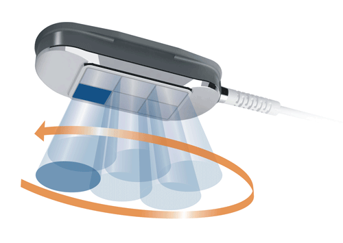 Handsfreesono; Ultraschalltherapie